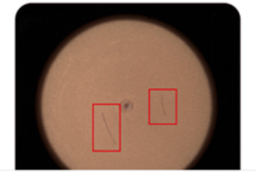 Visual Inspection of Surface Defects in Plastic Bottle Caps